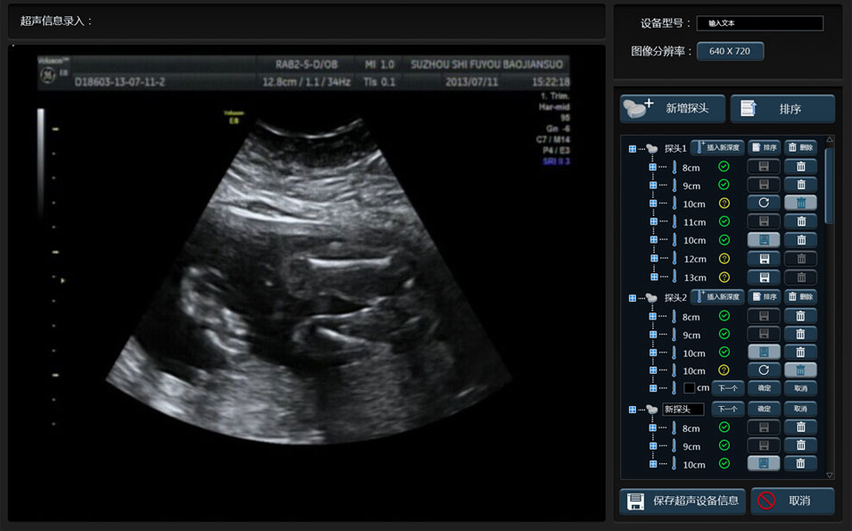 武漢睿影醫療科技超聲系統軟件界面設計